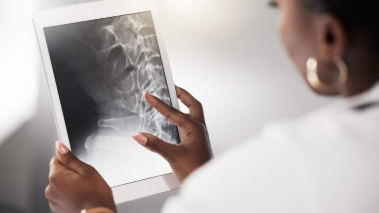 managing-inflammation-leads-to-healthier-bones-|-sixty-and-me-–-from-sixtyandme.com